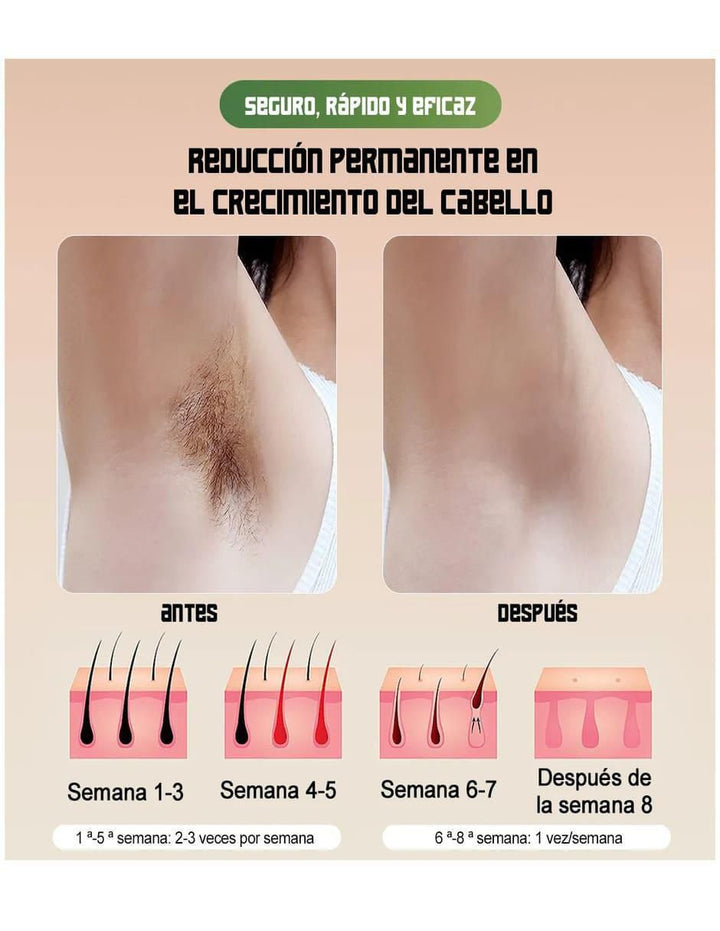 Depiladora IPL para Cuerpo y Rostro - Image 2