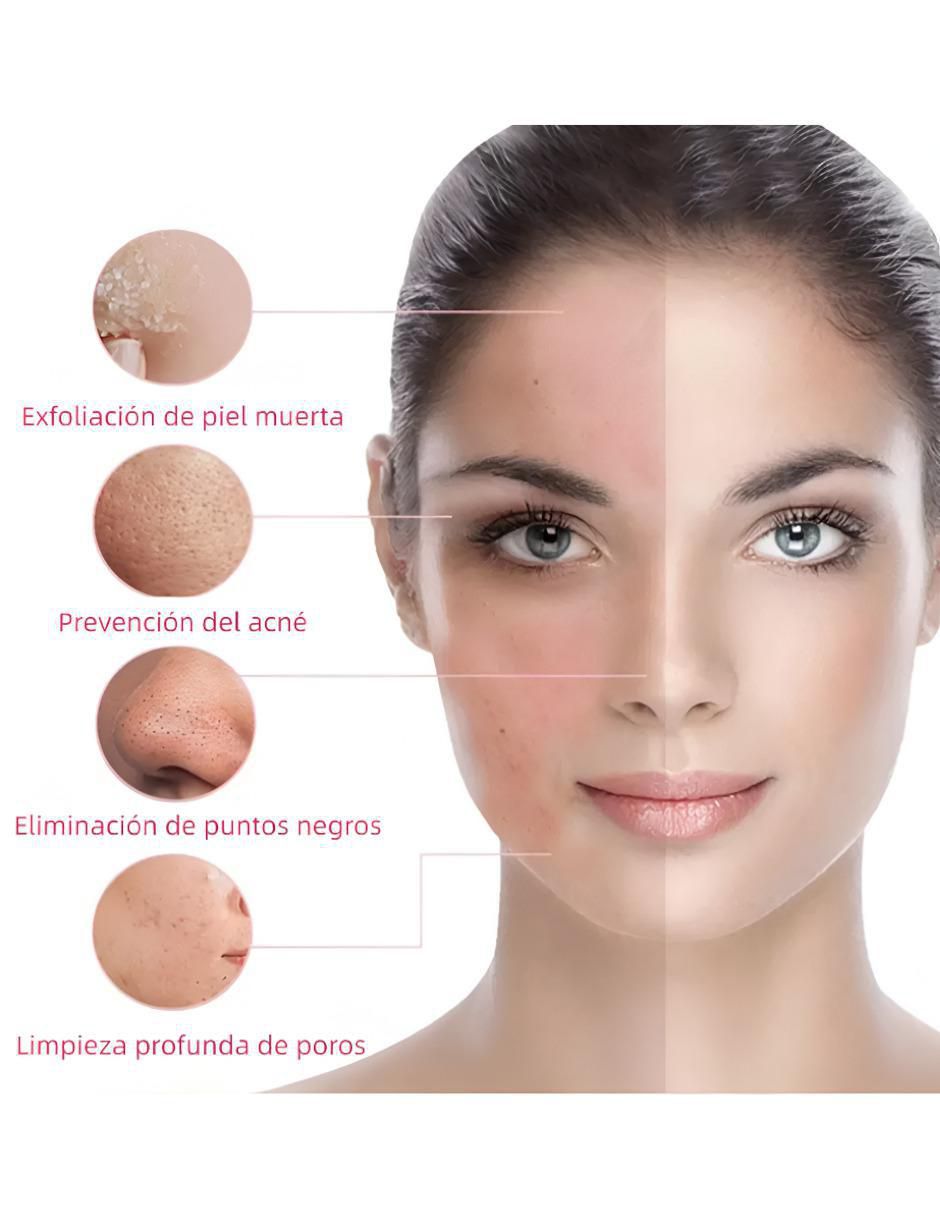 Cepillo Facial Eléctrico Limpieza - Image 3